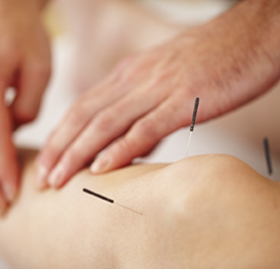 © Victory Megannety - Patient getting treatment on Acupuncture  -March 2012
